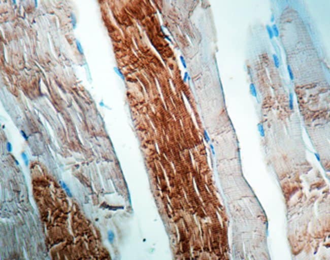 ALPHA SARCOMERIC ACTININ