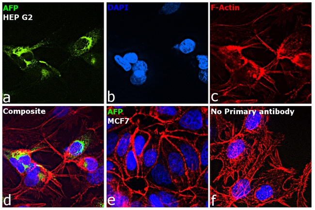 ALPHA FETOPROTEIN