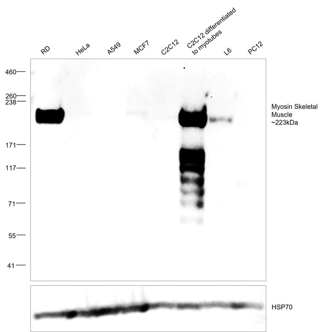 1 ML MYOSIN MOUSE MONOCLONAL ANTIBODY IG