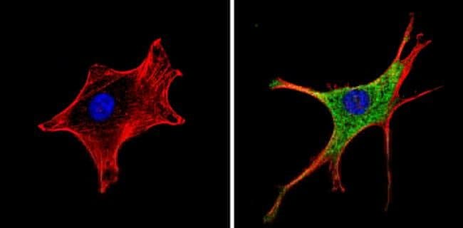 50UG Retinoic Acid Receptor alpha