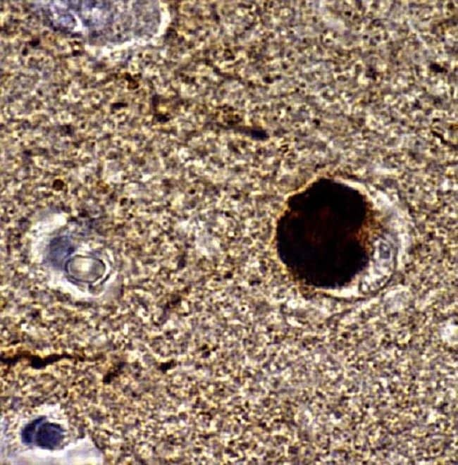 ALPHA SYNUCLEIN