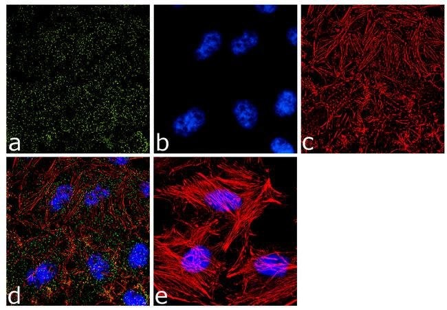 alpha Adaptin Mouse Monoclonal Ab, 100µl