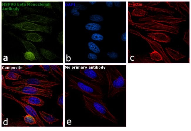 Anti-Hsp90 beta Monoclonal Antibody