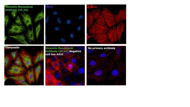 Anti-Vimentin Monoclonal Antibody