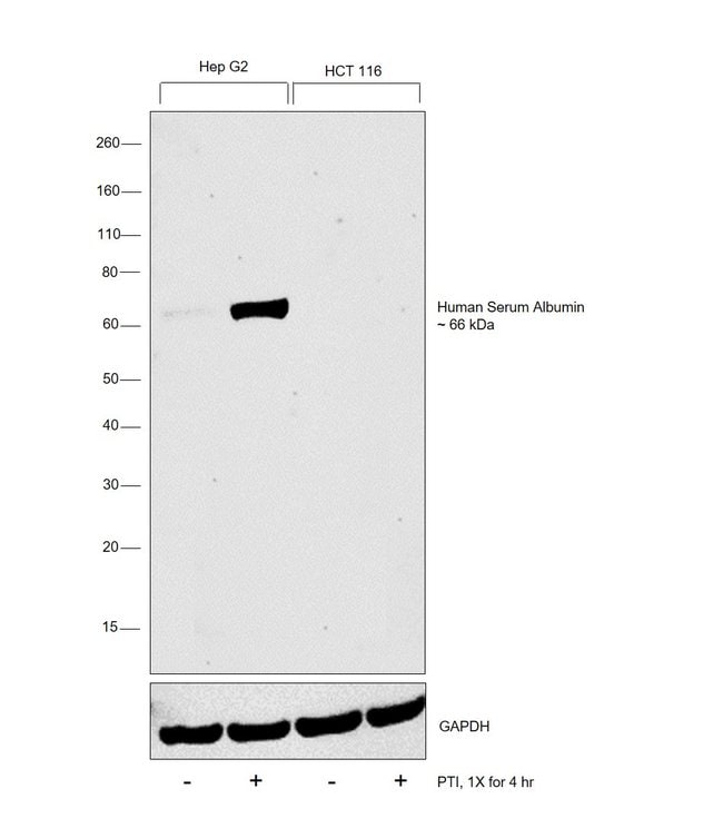 ALBUMIN