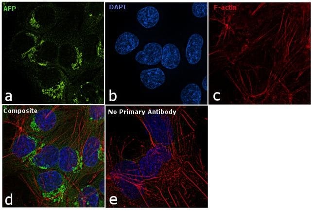 ALPHA FETOPROTEIN