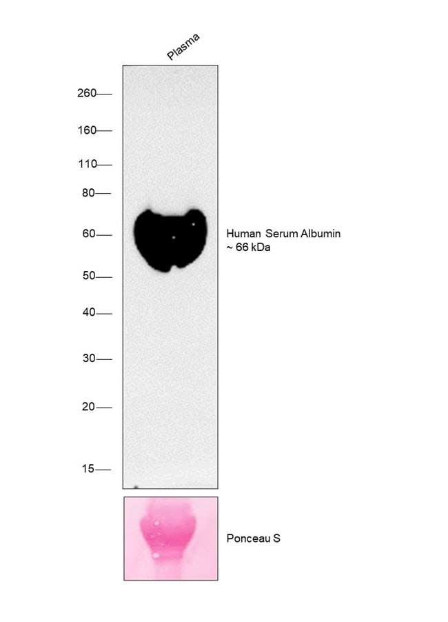 ALBUMIN