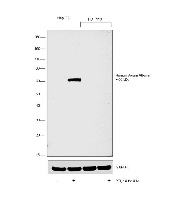 ALBUMIN