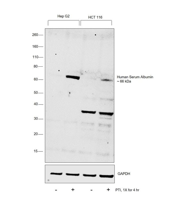 ALBUMIN