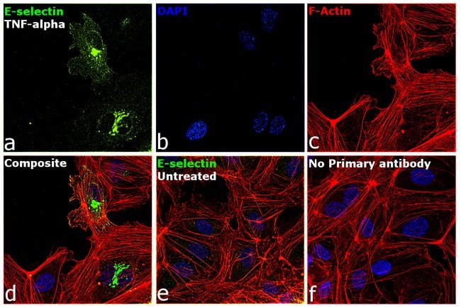 100UG CD62E Mouse monoclonal antibody Ig