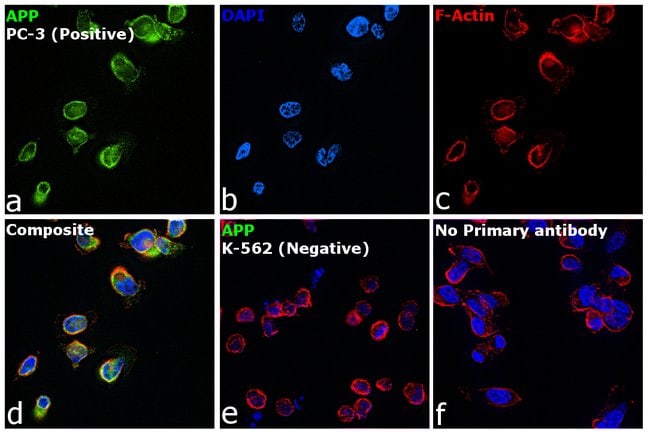 Amyloid beta Mouse Monoclonal Ab, 50µg,