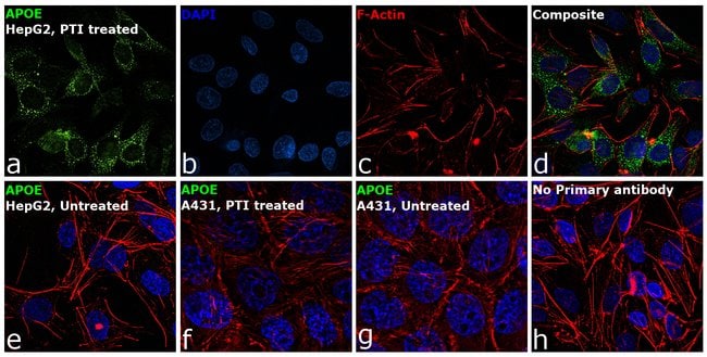 1 ML Apolipoprotein H Mouse monoclonal a