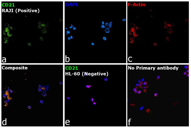 250UL CD21 Monoclonal Antibody (1F8)