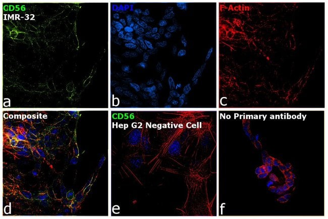 1 ML CD56 Mouse monoclonal antibody IgG1