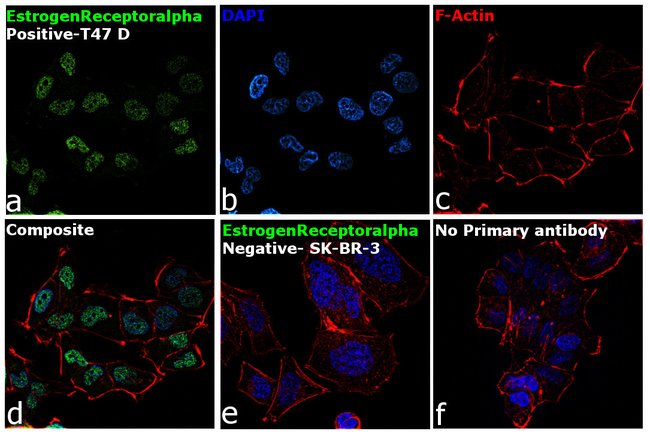 ANTI-ESTROGEN RECEPTOR MAB 1ml .