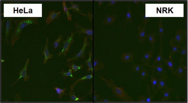 MAP2K4 MONOCLONAL ANTIBODY (2E4)