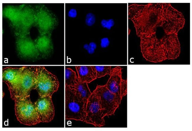 1 ML AGGRECAN MOUSE IGG1, K MAB, SPECIES