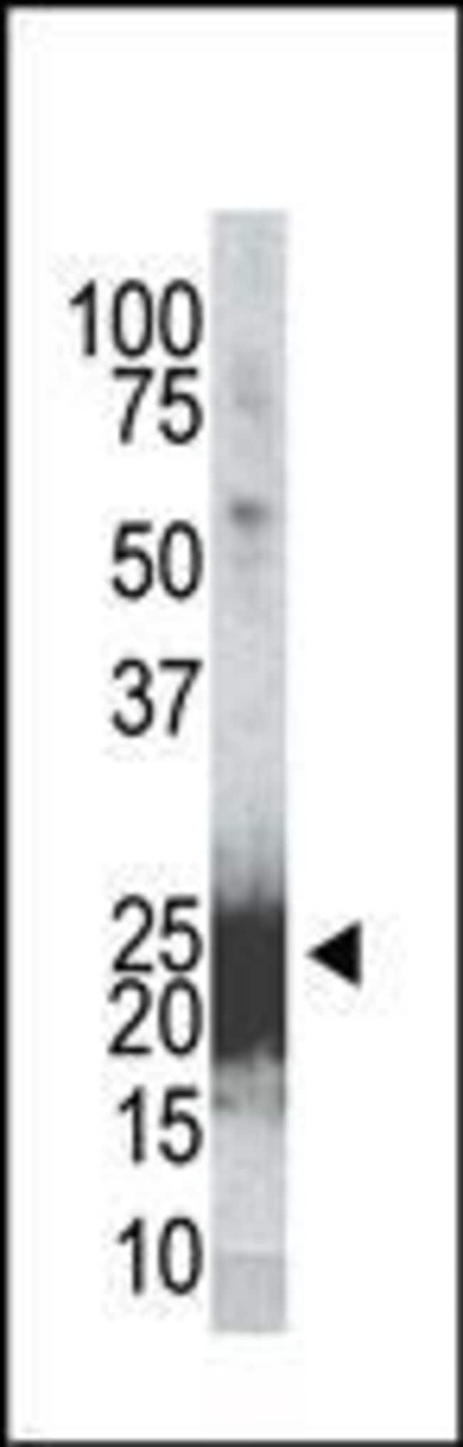 Anti-Phospho-mBad-Ser155 0.1 mg MG