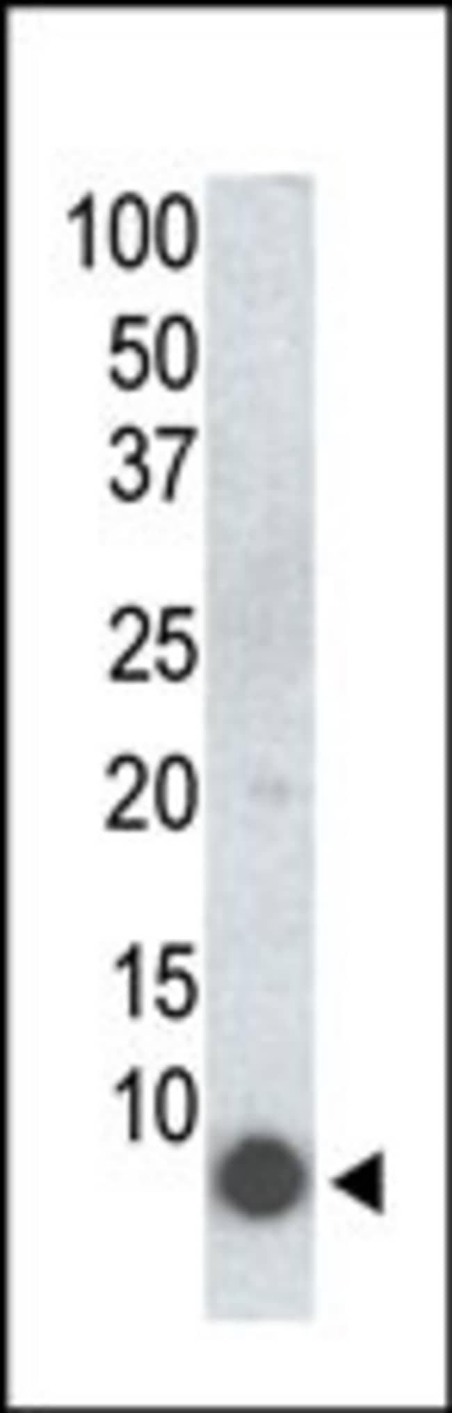 ANTI-PHOSPHO-PLM-S68, 0,1 MG