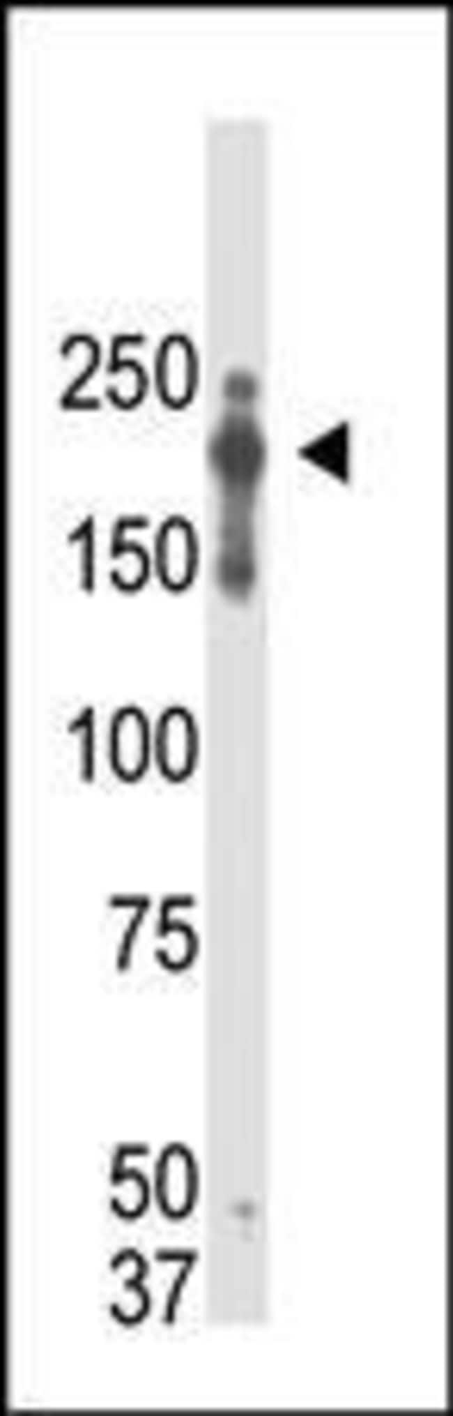 ANTI-PRDM2, 0,1 MG
