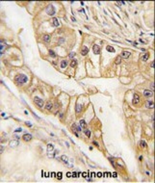 ANTI-EPHB2, 0,1mg .