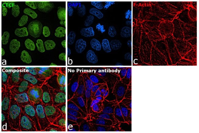 Anti-CTCF Antibody, 100µL ChIP assay dil