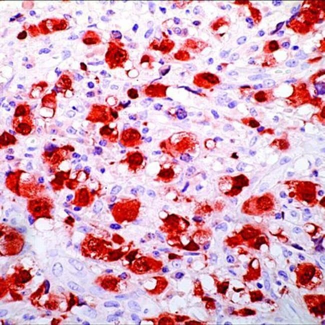 ALK / p80 (5A4) Ms mAb 1ml