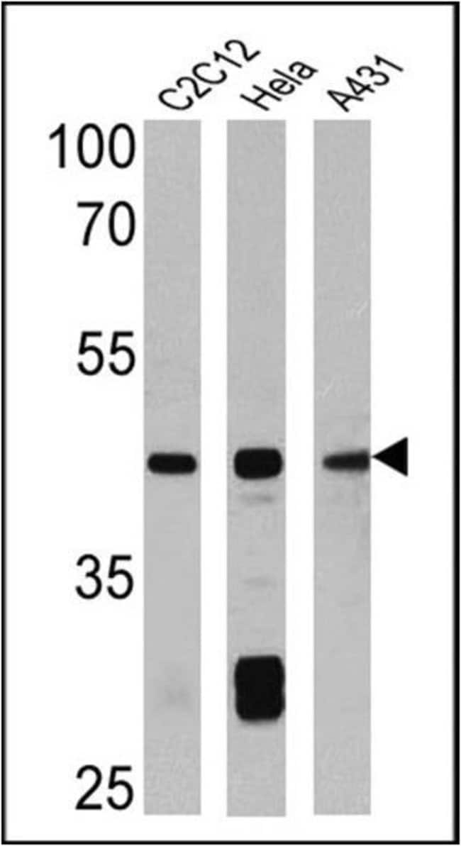 ACTIN SMOOTH MUSCLE MAB BIOTI CONJ
