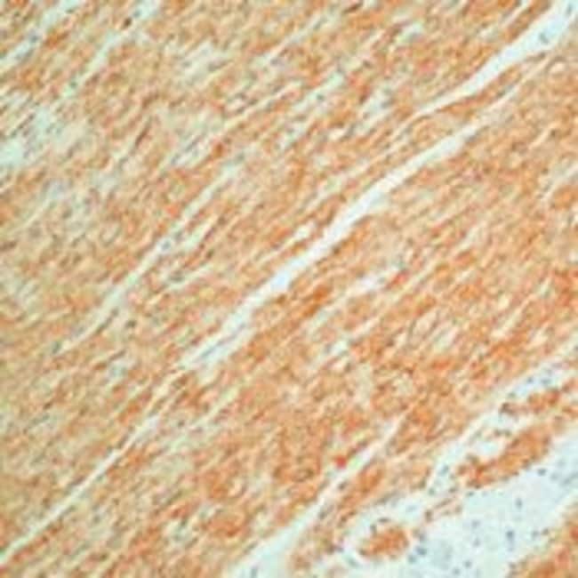 Actin Muscle Specific (MSA06 (HUC1-1)) M