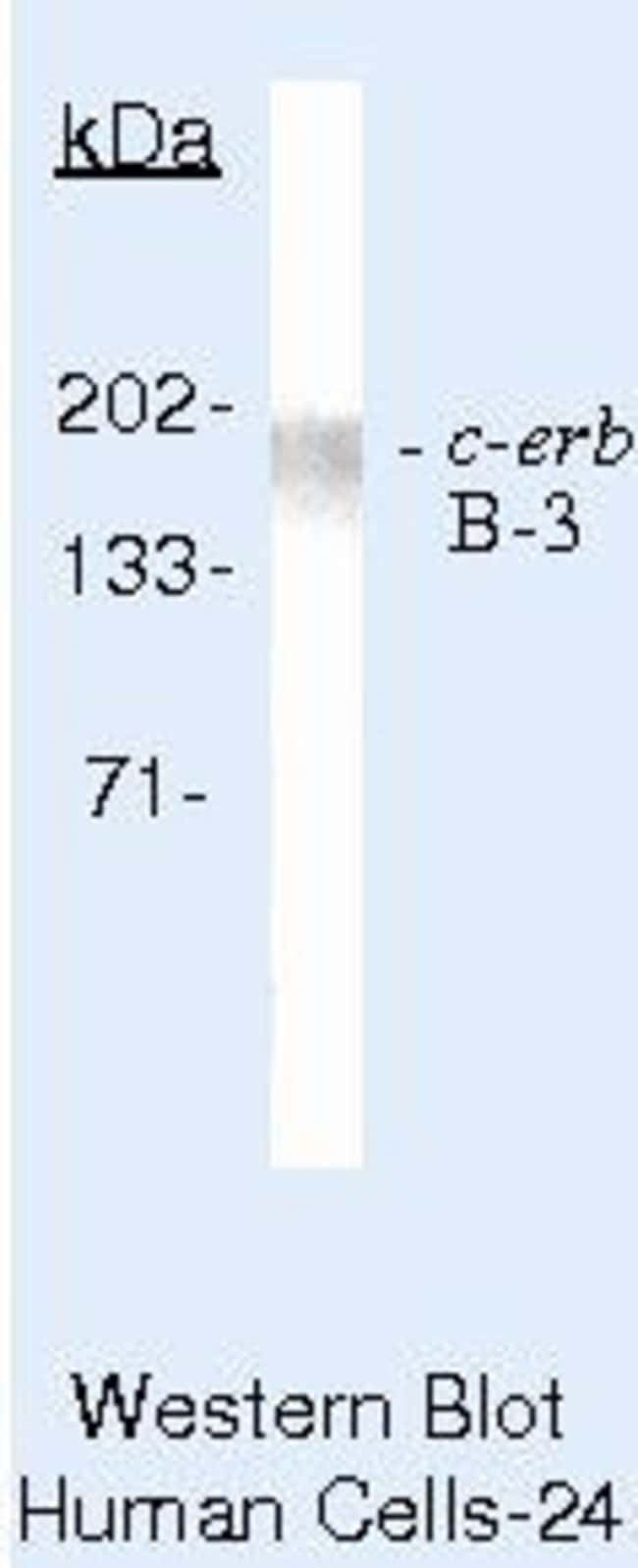 500UL HER2 MONOCLONAL ANTIBODY (L87+2ERB