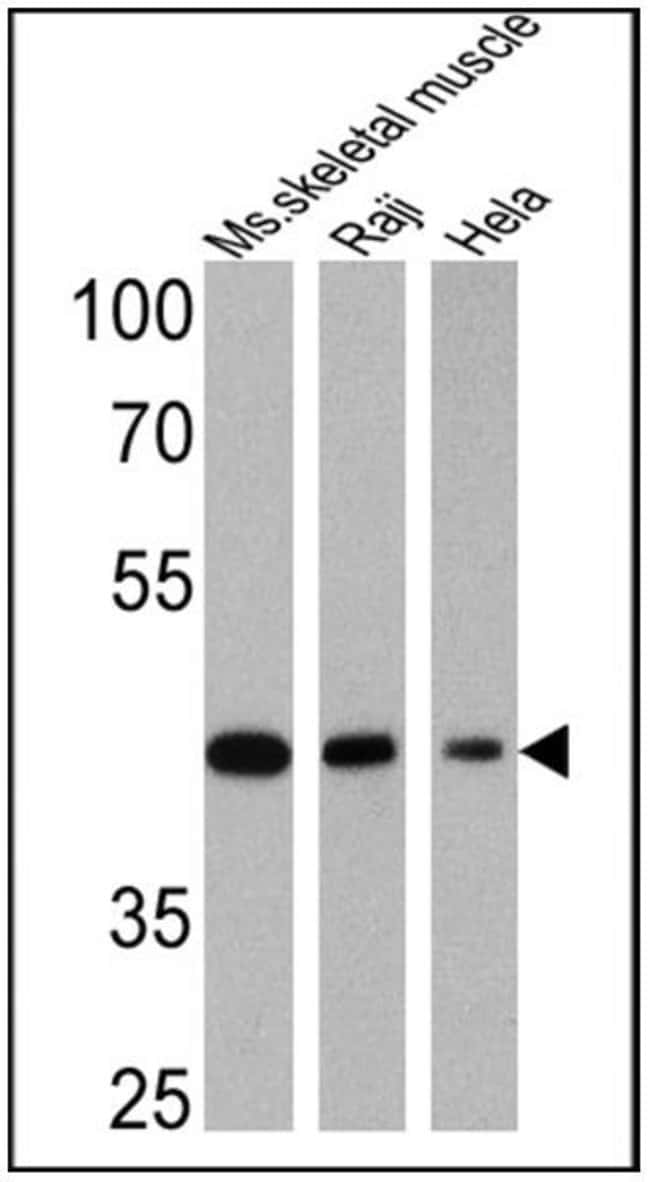 Actin Muscle Specific (HHF35) Mouse Mono