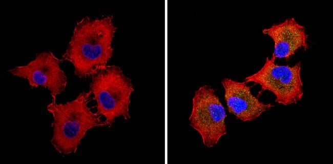 ALK (Anaplastic Lymphoma Kinase) / p80 (