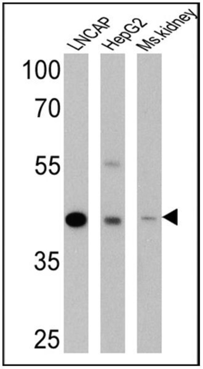 Alphamethylacyl-CoA-racemase (13H4) Rabb