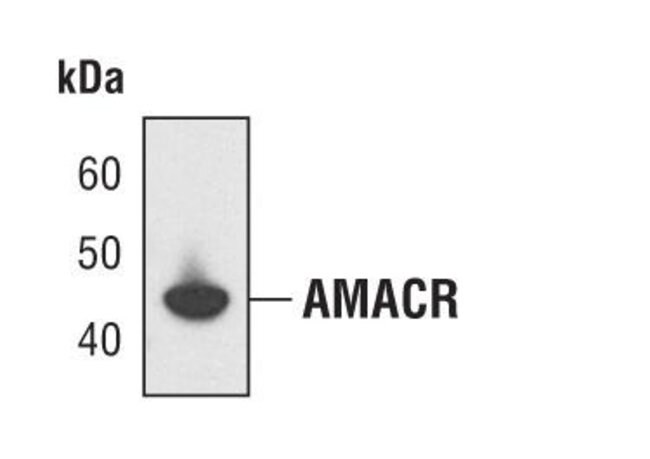 AMACR, 100 µL