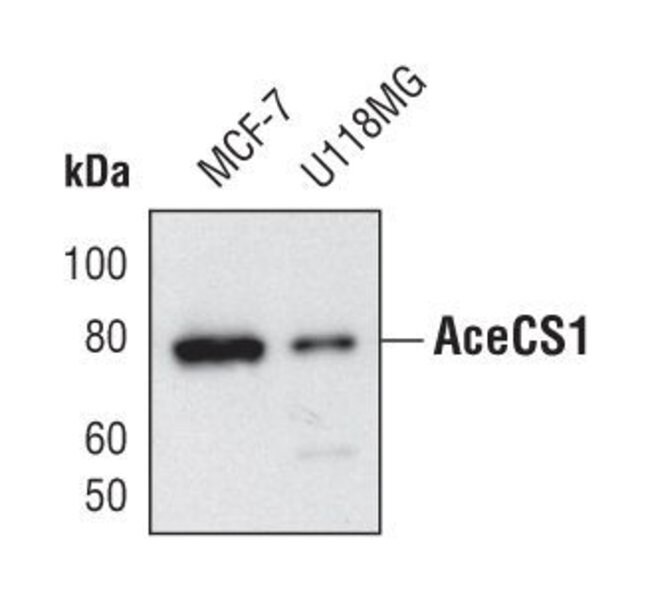 ACECS1, 100 µL