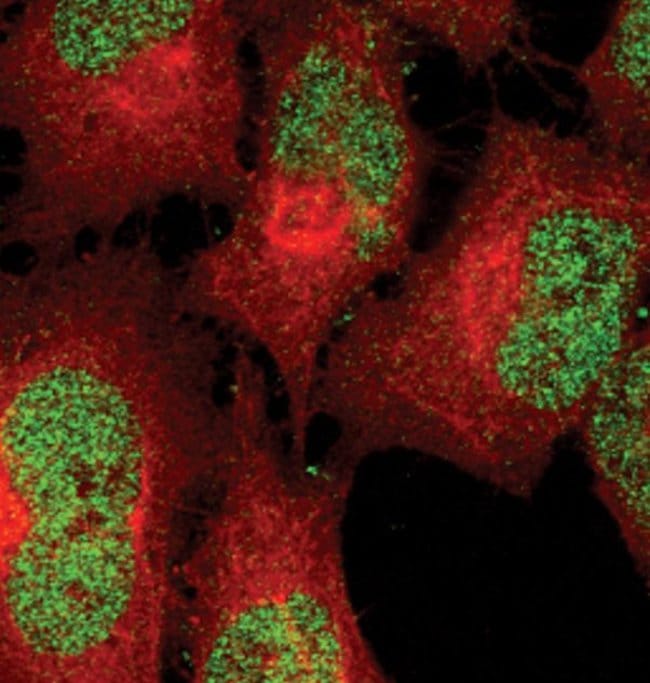 100UL PHOSPHO-STAT5 (TYR694) .