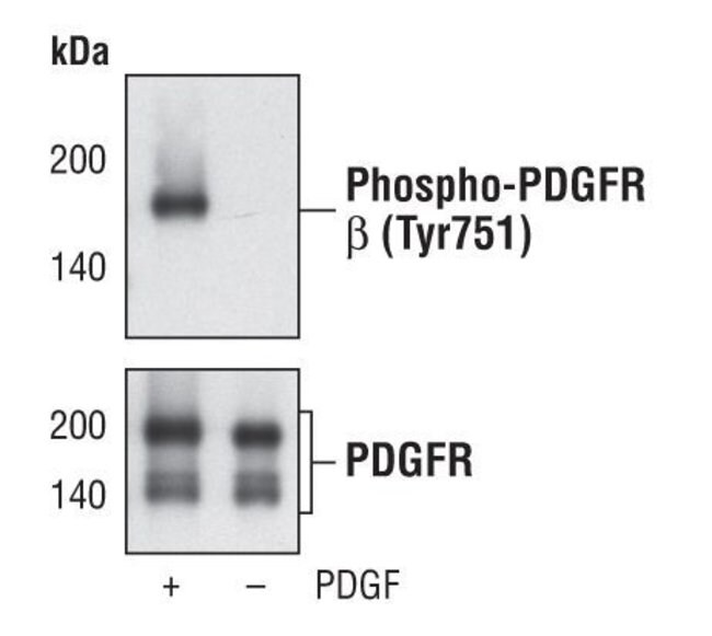 Antibody Phospho-PDGF Receptor beta (Tyr