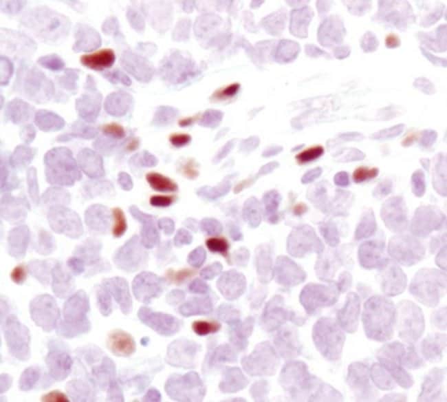 5-LIPOXYGENASE, 100 µL