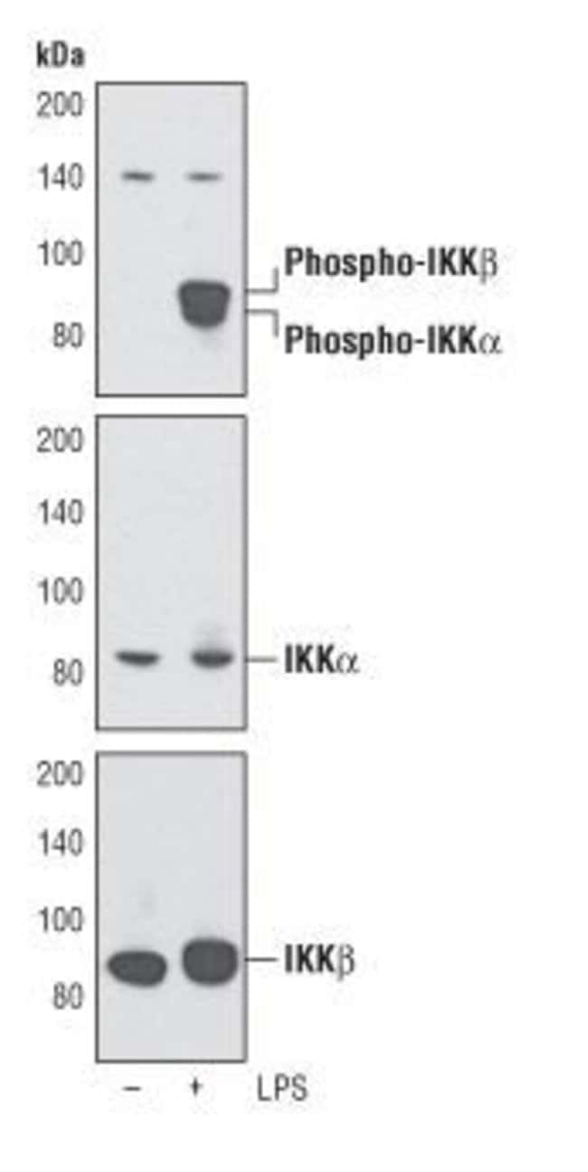 Antibody Phospho-IKK-alpha (Ser176)/ IKK