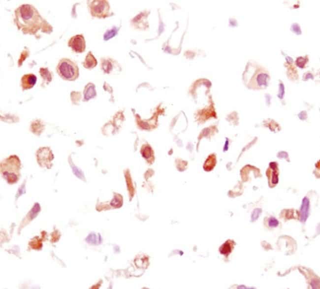 100UL PHOSPHO-GSK-3BETA (SER9) .