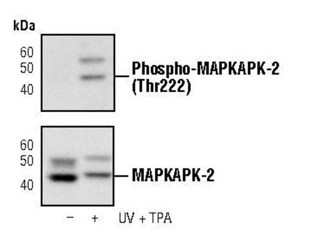 100UL PHOSPHO-MAPKAPK-2 (THR222) .