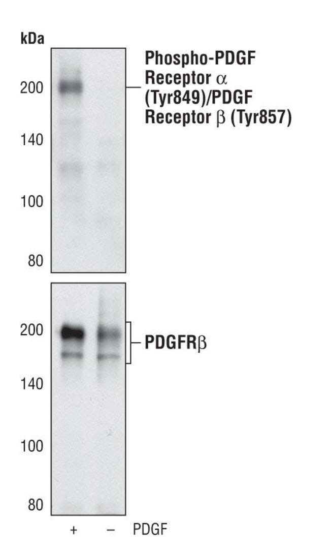 Antib. Phospho-PDGF Recep. alpha (Tyr849