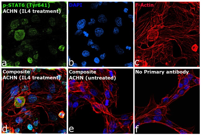 100UL PHOSPHO-STAT6 (TYR641) .