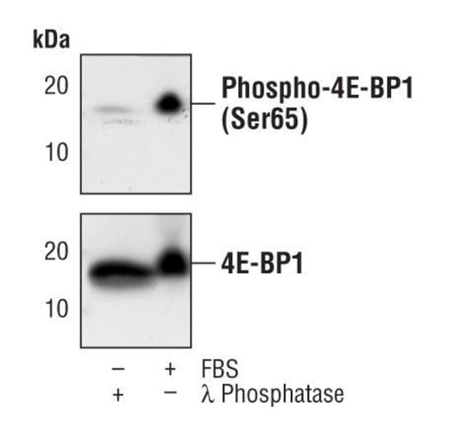 100UL PHOSPHO-4E-BP1 (SER65) .