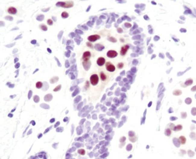 100UL PHOSPHO-STAT5 (TYR694) .