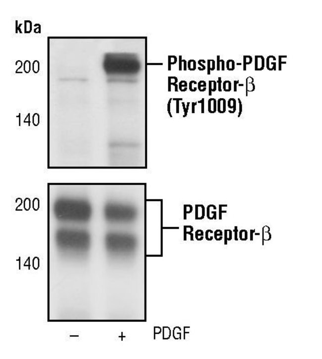 Antibody Phospho-PDGF Receptor beta (Tyr