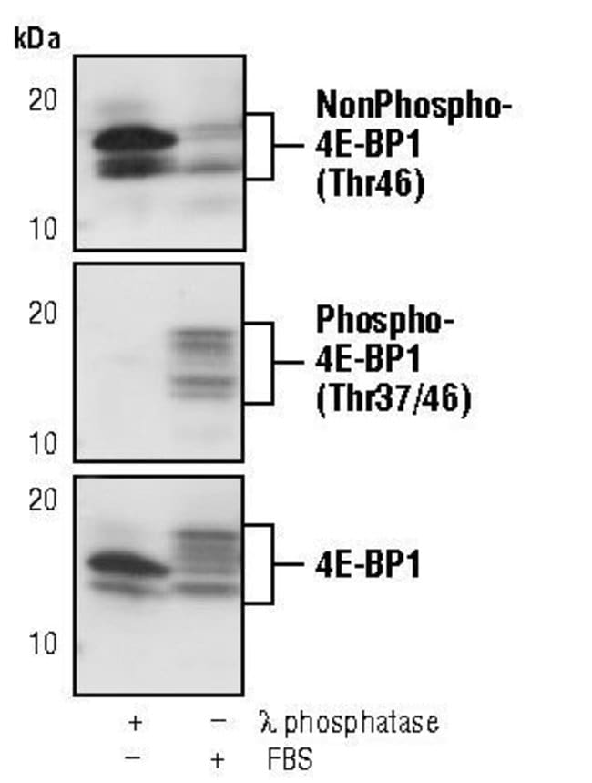 100UL NONPHOSPHO-4E-BP1 (THR46) .