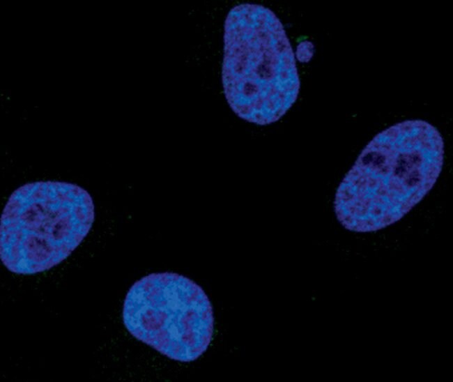 100UL PHOSPHO-STAT1 (TYR701) .