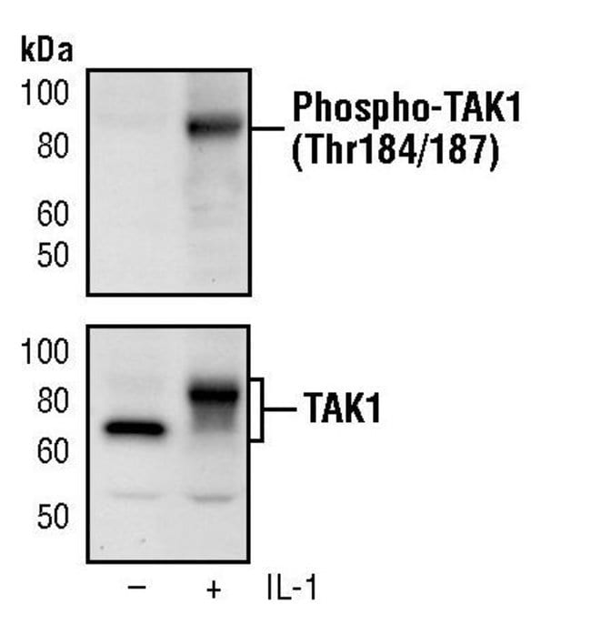 100UL PHOSPHO-TAK1 (THR184/187) .