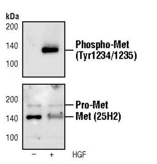 100UL PHOSPHO-MET (TYR1234/1235) .